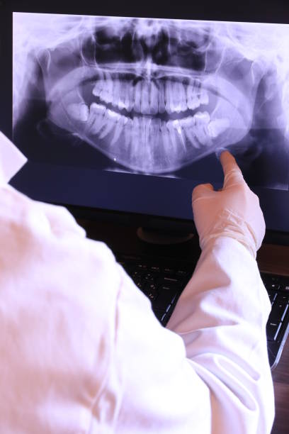 Best Emergency Gum Treatment in Fort Atkinson, WI