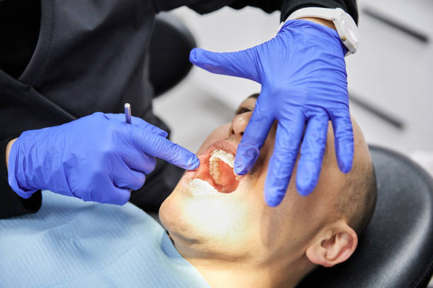 Best Emergency Dental Care for Broken or Chipped Teeth in Fort Atkinson, WI